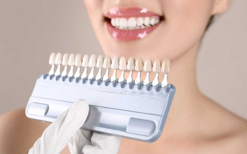 How Dental Veneers Address Uneven Teeth Sizes and Shapes