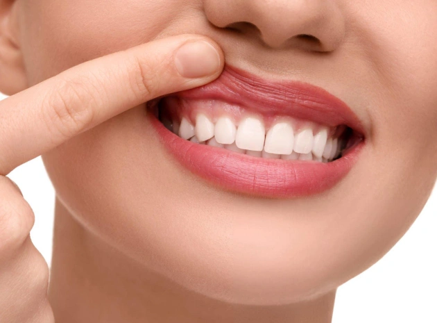 gold-coast-dental-center-periodontal-gum-care-in-fort-lauderdale